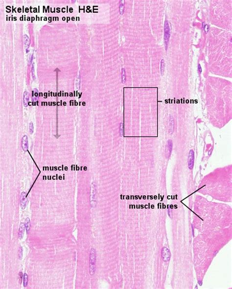 You can also find smooth muscle in the walls of passageways, including arteries and veins of de cardiovascular system. 17 Best images about Histology - Muscle on Pinterest ...