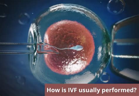 What Is Ivf How Is Ivf Usually Performed Results Of Ivf Procedure