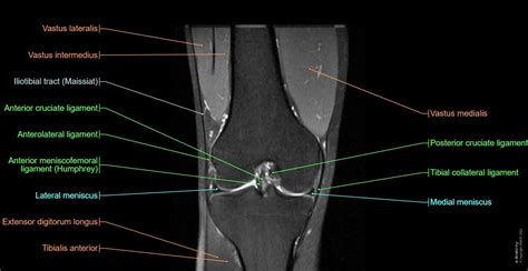 The Knee Mri Atlas Of Anatomy In Medical Imagery E Anatomy