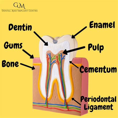 What Causes Dental Cavities Gm Dental And Implant Centre Rochester