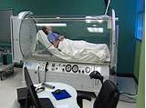 Images of Hyperbaric Oxygen Treatment For Cancer