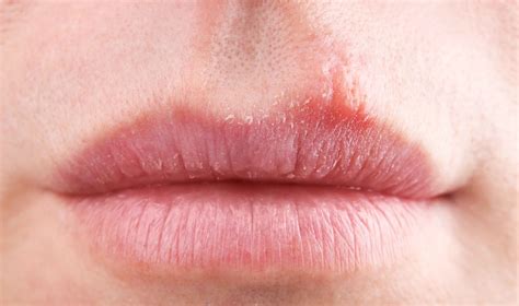 嘴巴经常干燥起皮，或与这7个因素有关，了解后，需对应调理凤凰网北美凤凰网