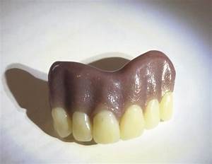 Denture Teeth Shading Gum Colour Marlborough Dental Lab In Norfolk