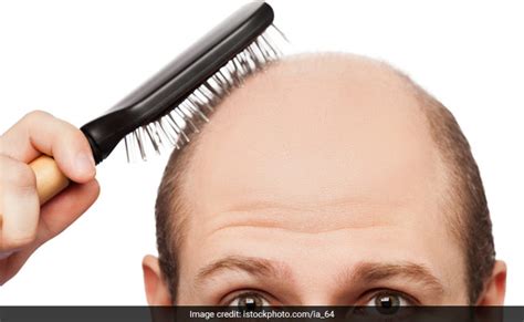 What Diseases Can Make Your Hair Fall Out What Causes Sudden Hair