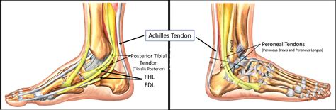 The common flexor tendon is a tendon that attaches to the medial epicondyle of the humerus (lower part of the bone of the upper arm that is near the elbow joint). Do You Have an Ankle Tendon Tear? Most don't need surgery...