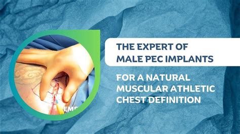 The Expert Of Male Pec Implants For A Natural Muscular Athletic Chest