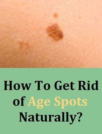 How To Get Rid Of Age Spots Naturally How To Get Rid Age Spots Hair