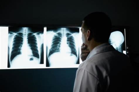 L' embolie pulmonaire reste une pathologie fréquente et récidivante, notamment chez le sujet âgé. Fibrose pulmonaire idiopathique : une maladie rare mais grave