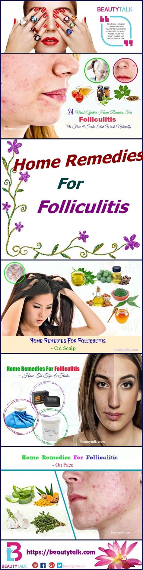 24 Most Effective Home Remedies For Folliculitis On Face And Scalp That