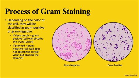 The Differences Between Gram Positive And Gram Negative Bacteria Mcat