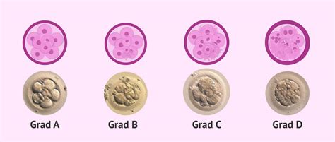 Einteilung Von Embryonen Nach Qualität