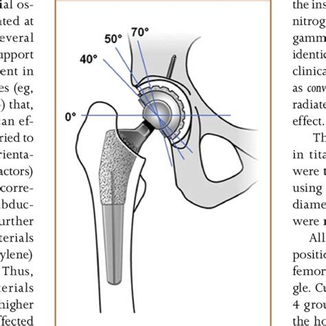 Schematic Diagram Of 4 Acetabular Cup Abduction Angles During Hip