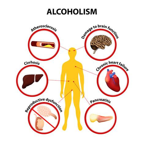 Learn The Facts On Alcohol And The Dangers Of Addiction Greater Waterbury Imaging Center