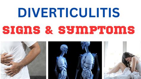 Diverticulitis Signs And Symptoms How To Reduce The Risk Of