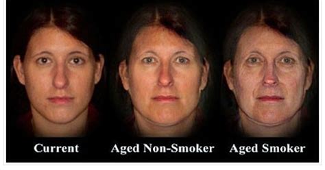 How Smoking Accelerates The Aging Process