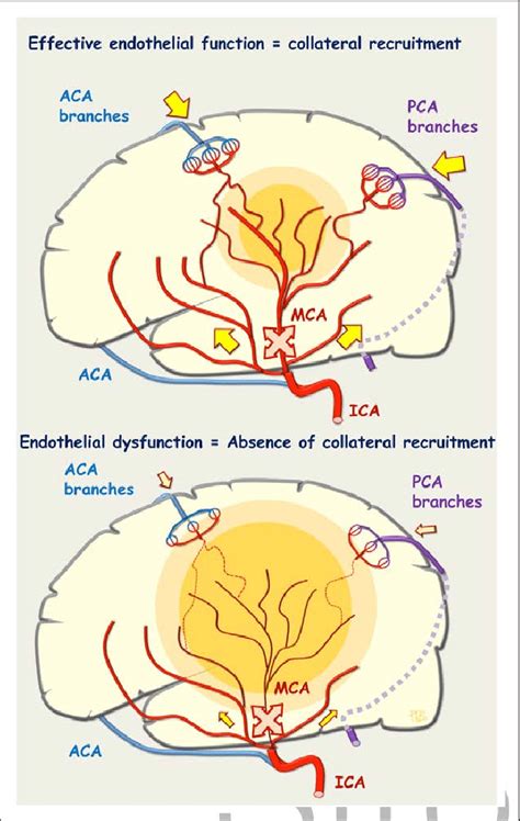 Collateral Recruitment After Middle Cerebral Artery Occlusion MCA Download Scientific Diagram