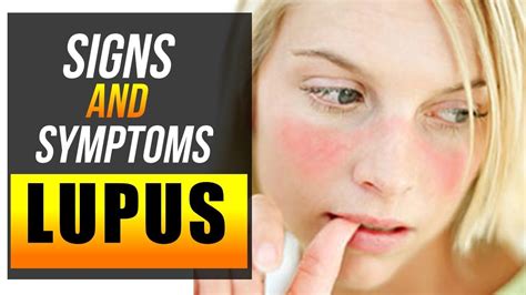 What Are The Symptoms Of Lupus Factual Facts Facts About The World