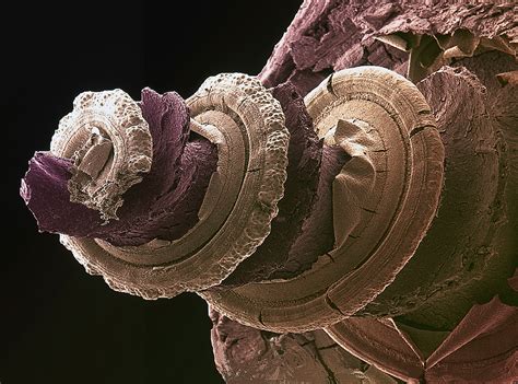 Cochlea Of The Inner Ear Coloured Brown Wellcome Collection