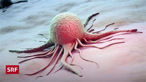 Neue Krebstherapien Wie Lange Können Wir Sie Uns Leisten Kontext Srf