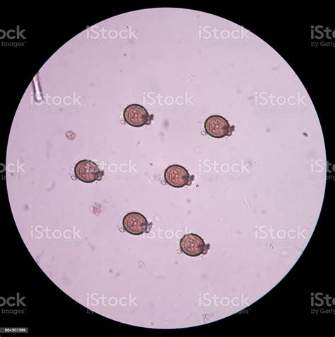 Tablet pills in blister pack on white background. Eggs Of Parasite In Stool Exam Human Stock Photo - Download Image Now - iStock