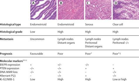 Classification Of Endometrial Carcinoma More Than Two Types The