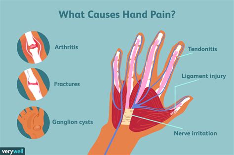 Douleurs Des Mains Causes Traitement Et Quand Consulter Un Médecin