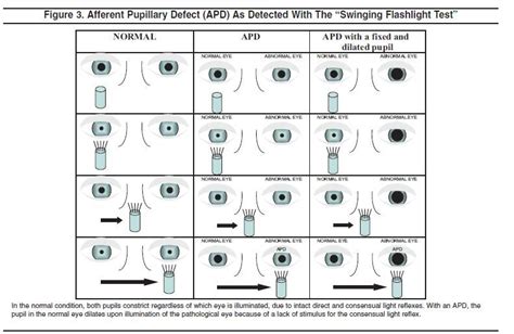 Pupil Size Chart Pdf Related Keywords And Suggestions