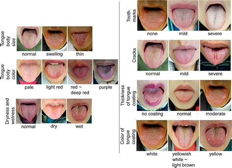 Frontiers Construction Of A Standardized Tongue Image Database For Diagnostic Education