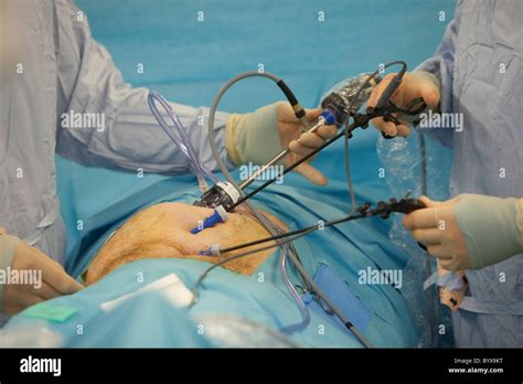 Hernia Inguinal Y Laparoscopia