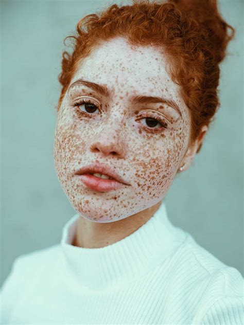 Photographer Captures The Beauty Of Freckles In All Their Glory
