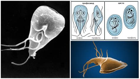 Giardia In Adults Symptoms And Treatment Photo 12696 Hot Sex Picture