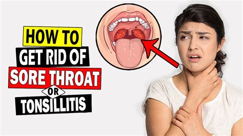 How To Cure Tonsillitis Fast At Home Sore Throat Treatment Home