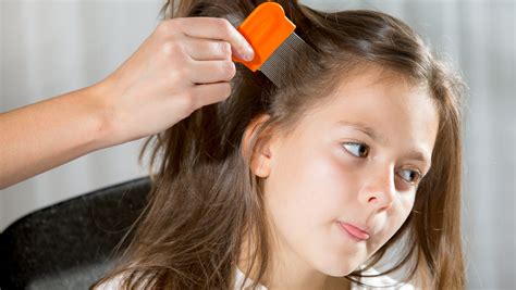 How To Prevent And Treat Head Lice