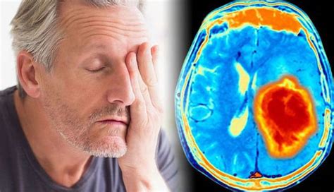 3 Major Causes And Symptoms Of Brain Tumor