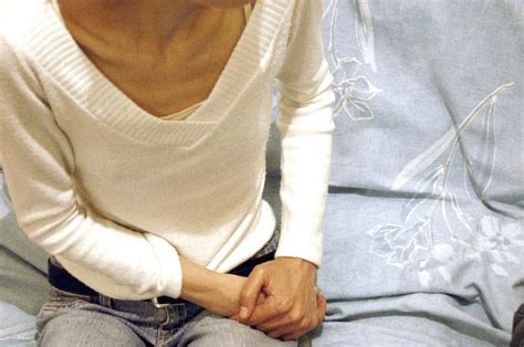 Bulimia Y Anorexia Requieren Tratamiento Interdisciplinario El Siglo De Torreón