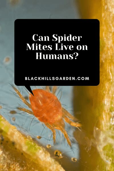 Can Spider Mites Live On Humans