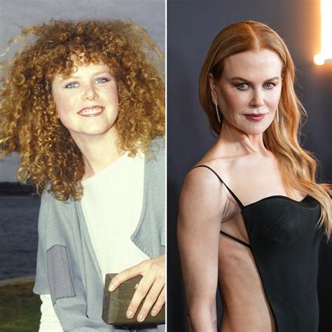 Nicole Before And After