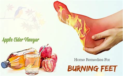 Top 14 Best Home Remedies For Burning Feet And Toes