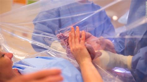 Gentle C Sections Are Growing In Popularity With Images C Section Breastfeeding After C