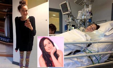 mother releases photos of anorexic daughter emma duffy whi who hasn t eaten for a year daily