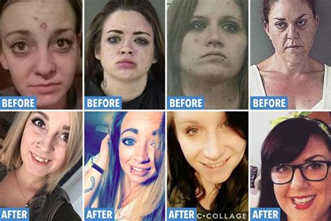 shocking before and after photos show the devastating impact of drug addiction and the stunning