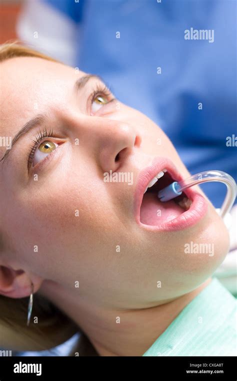 Woman Patient At Dentist Open Mouth With Suction Hose Close Up Stock Photo Alamy