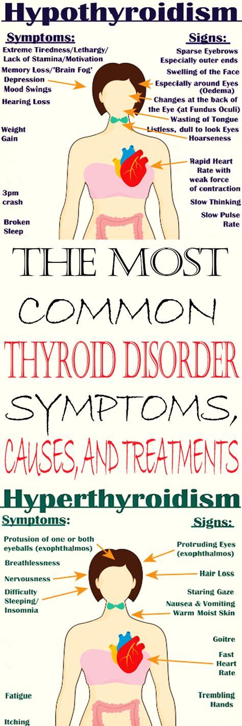 everything you need to know about every thyroid disorder signs symptoms causes treatments