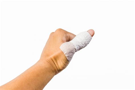 Sprained Thumb Treatment Recovery And Symptoms