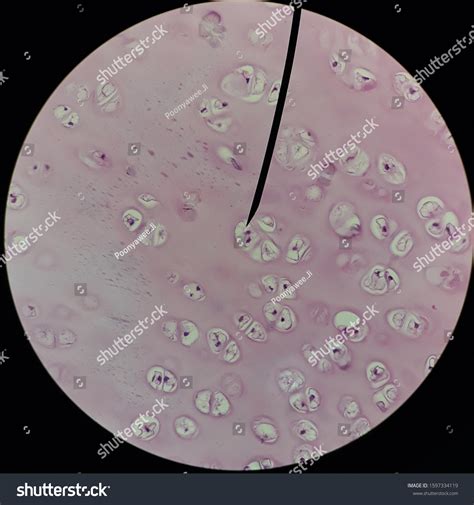 Hyaline Cartilage Under Light Microscope X Stock Photo