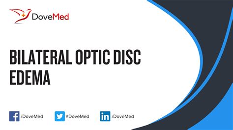 Bilateral Optic Disc Edema