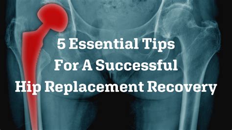 5 Essential Tips For A Successful Hip Replacement Recovery Brian Johns
