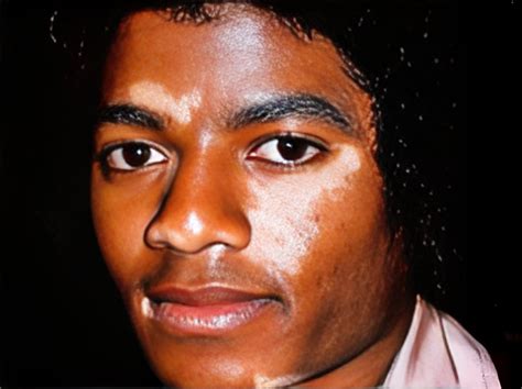 Did Michael Jackson Have Vitiligo Beauty Style Blog