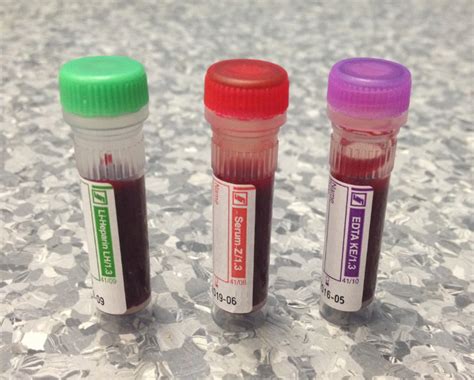 What Can Your Horses Blood Tell You Westvets Veterinary Practice