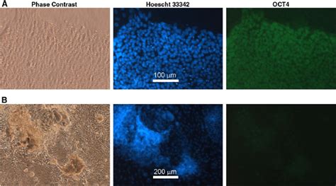 Human Embryonic Stem Cells Hesc Cultured In An Undifferentiated State